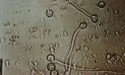 Germ Tube Test